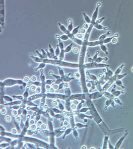 Botrytis cinerea en frutilla/fresa